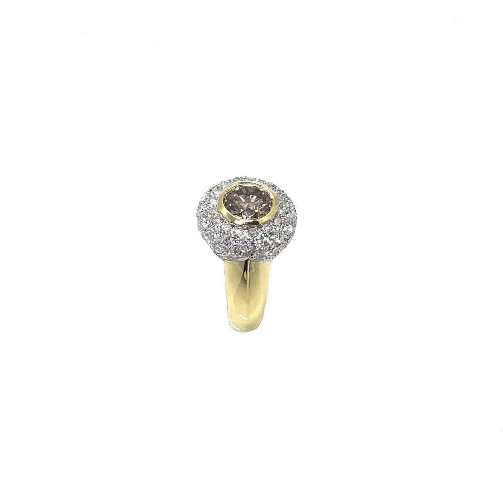 Anello Bottone